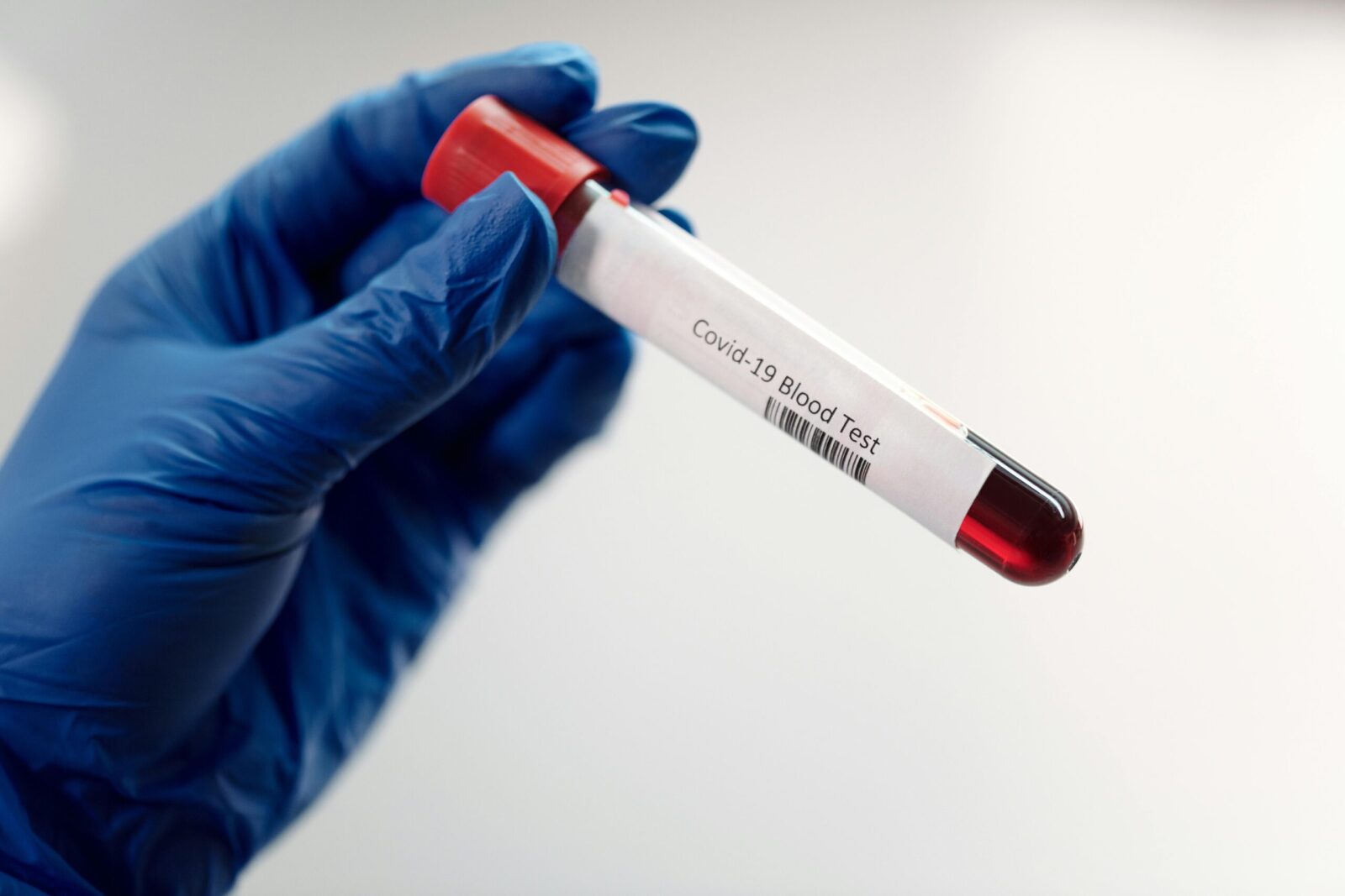 Medical professional holding Covid-19 blood test sample in laboratory, highlighting healthcare research.